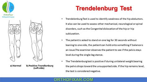 trendelenburg hip test results